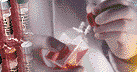 Adenomyosis cell culture